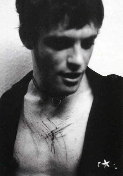 Photograph of Edwards with auto-mutilation on body.